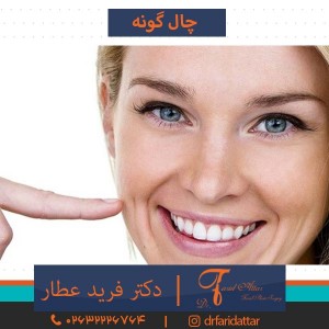 چاله گونه