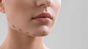مراقبت های بعد از پروتز چانه