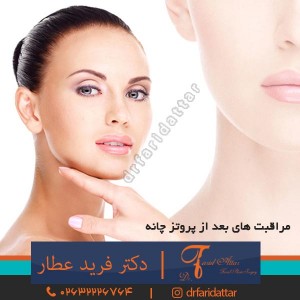 مراقبت های بعد از پروتز چانه