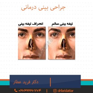جراحی بینی درمانی