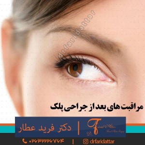 مراقبت های بعد از جراحی پلک