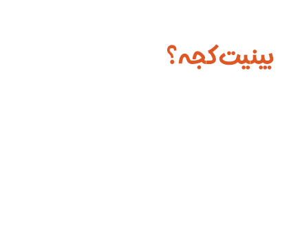 نمونه کار جراحی بینی کج