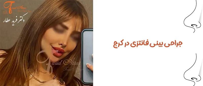 جراحی بینی فانتزی در کرج