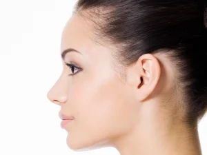 جراحی بینی طبیعی در کرج